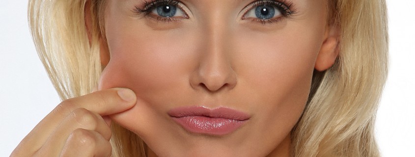 Facelift