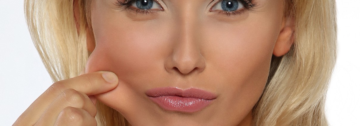 Facelift
