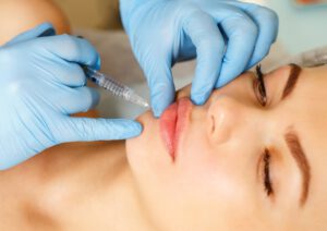 Lippenunterspritzung-frankfurt Eine Frau auf der Liege und eine Ärztin die Ihr gerade die Lippen unterspritzt.