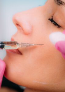 Ein weibliches Gesicht während einer PRP-Behandlung (Platelet-Rich Plasma), bei der das Eigenblut der Patientin zur Hautverjüngung eingesetzt wird.