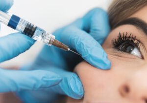 hyaluronsäure-wiesbaden Ein weibliches Gesicht während einer Unterspritzung mit Hyaluronsäure