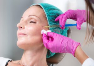 Ein weibliches Gesicht während einer Unterspritzung mit Hyaluronsäure