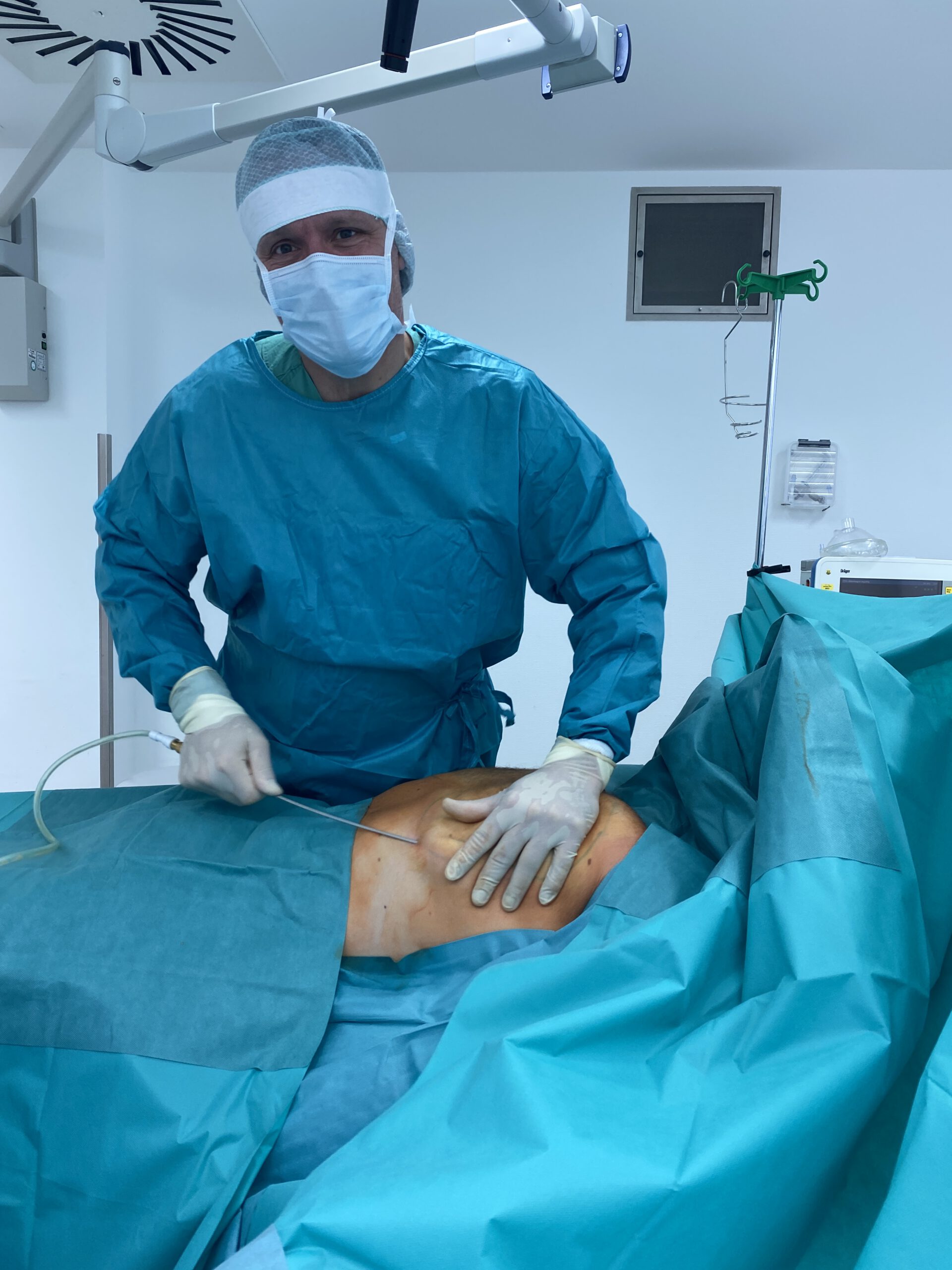 Liposuktion intraoperativ